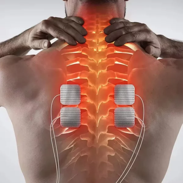 Appareil de physiothérapie interférentielle – Image 7