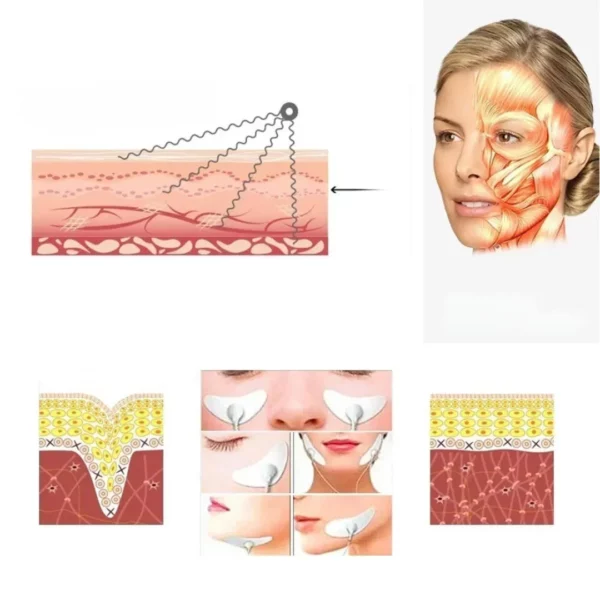 Masseur Facial EMS – Image 3